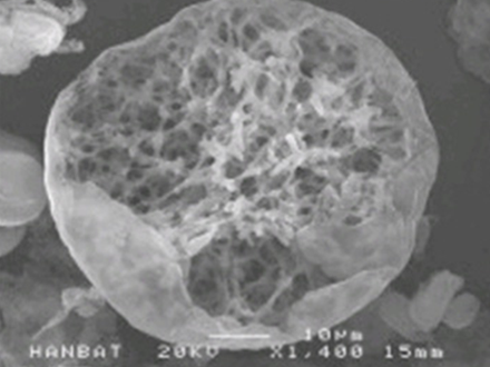 내부의 그물모양의 망상구조