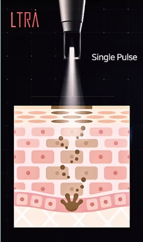 Single Pulse